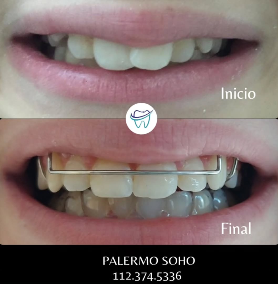 Caso 2 - Antes y Después